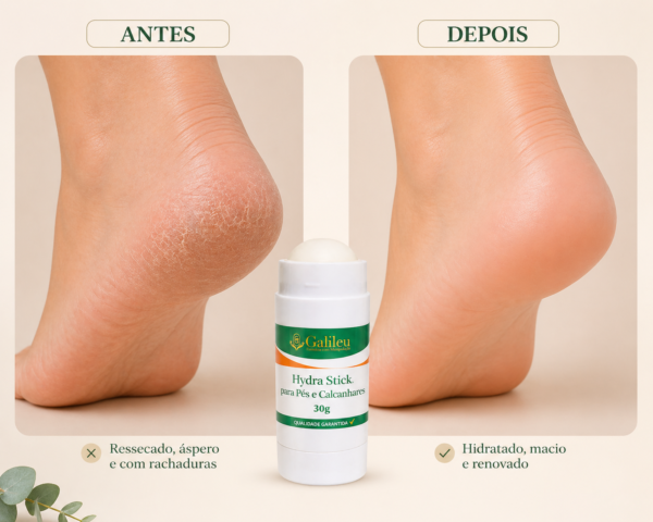 Hydra Stick pés hidratação intensiva 30g bastão hidratante para pés
